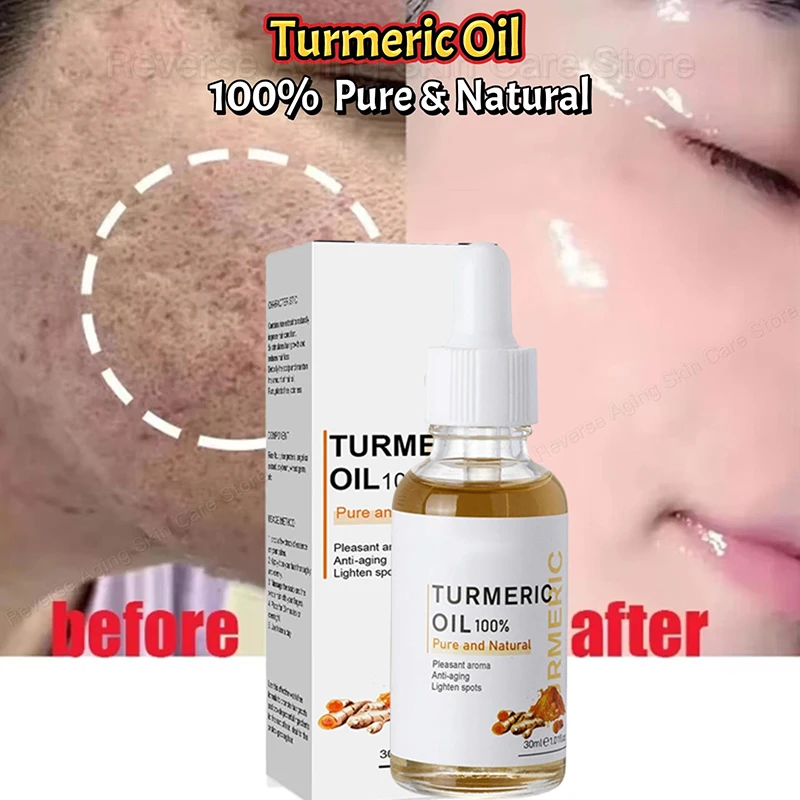 

Whitening Freckles Serum Remove Dark Spots Melasma Lighten Melanin Anti-aging Moisturizing Facial Brighten Turmeric Oil SkinCare