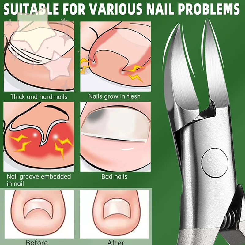 المهنية حادة المائل الفم مسمار كليبرز المتقلب مكافحة سبلاش أدوات باديكير بتقويم العمود الفقري العناية بالقدم #4