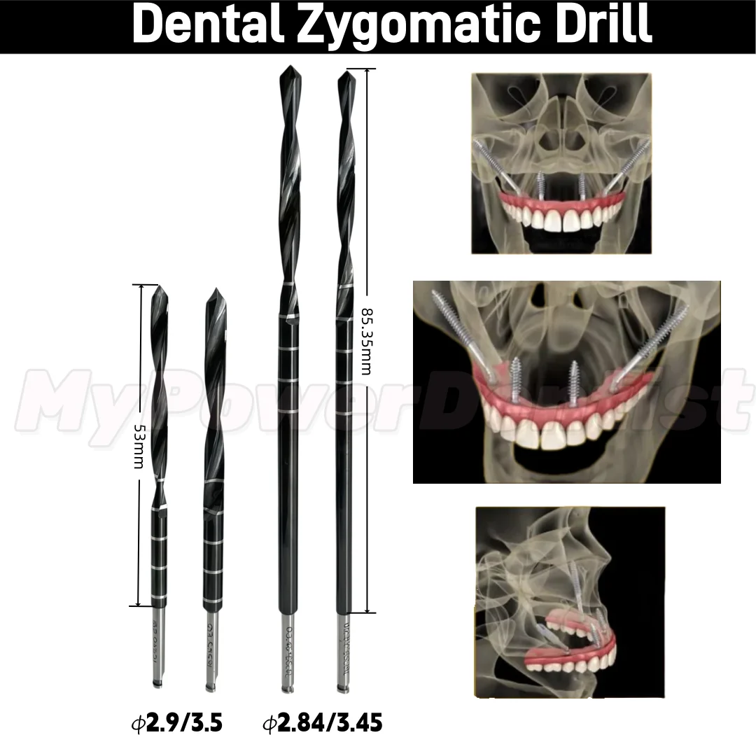 Dental Zygomatic Dr…