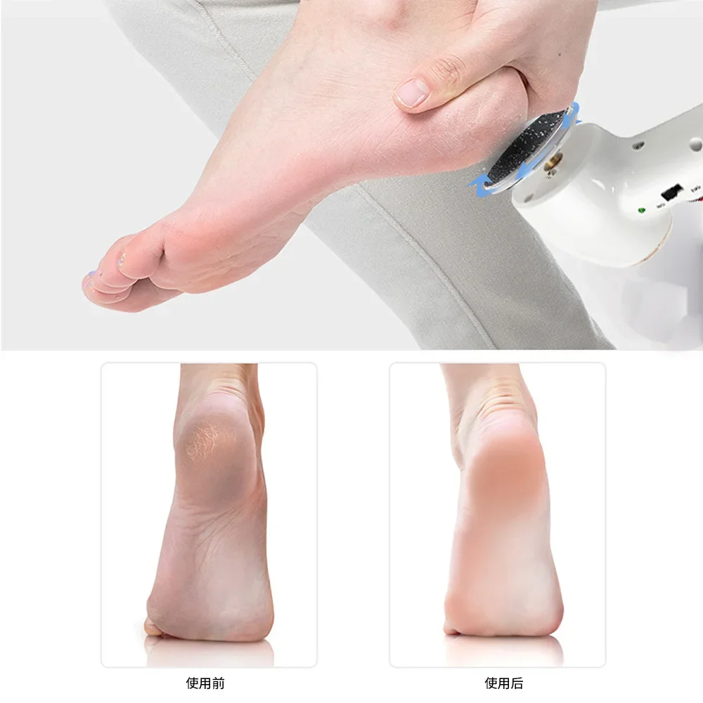 2 Speed Transfer Electric Pedicure Device, USB Rechargeable Dermabrasion Pedicure, Dead Skin Callus Remover for Foot Care