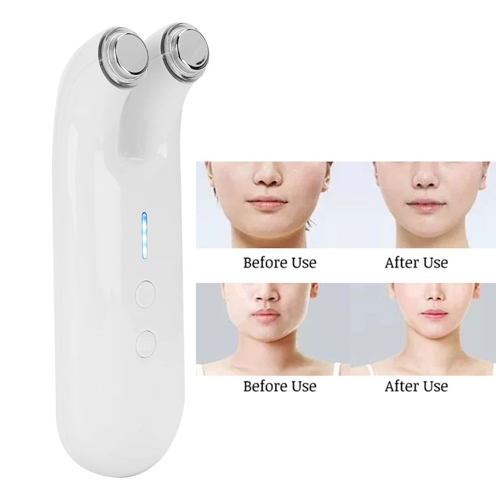 

EMS Beauty Machine EMS Massage Whitening Face Current Tight Lifting Anti-Aging Beauty Machine Face Lifting Beauty Machine