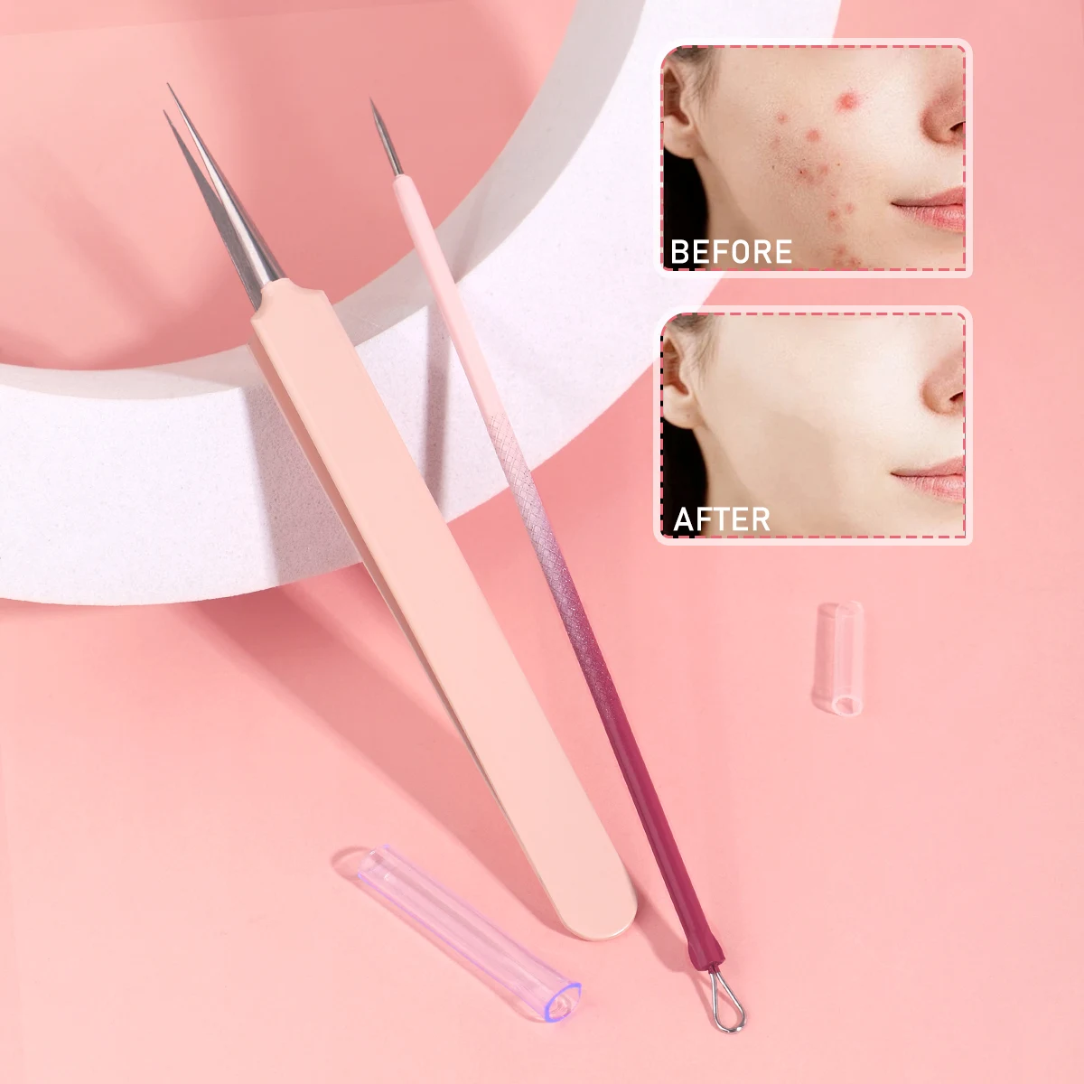 3-delige acne-naald, ultrafijne acne-naald voor het verwijderen van mee-eters en het gezichtsreiniging van acne, professioneel schoonheidshulpmiddel.