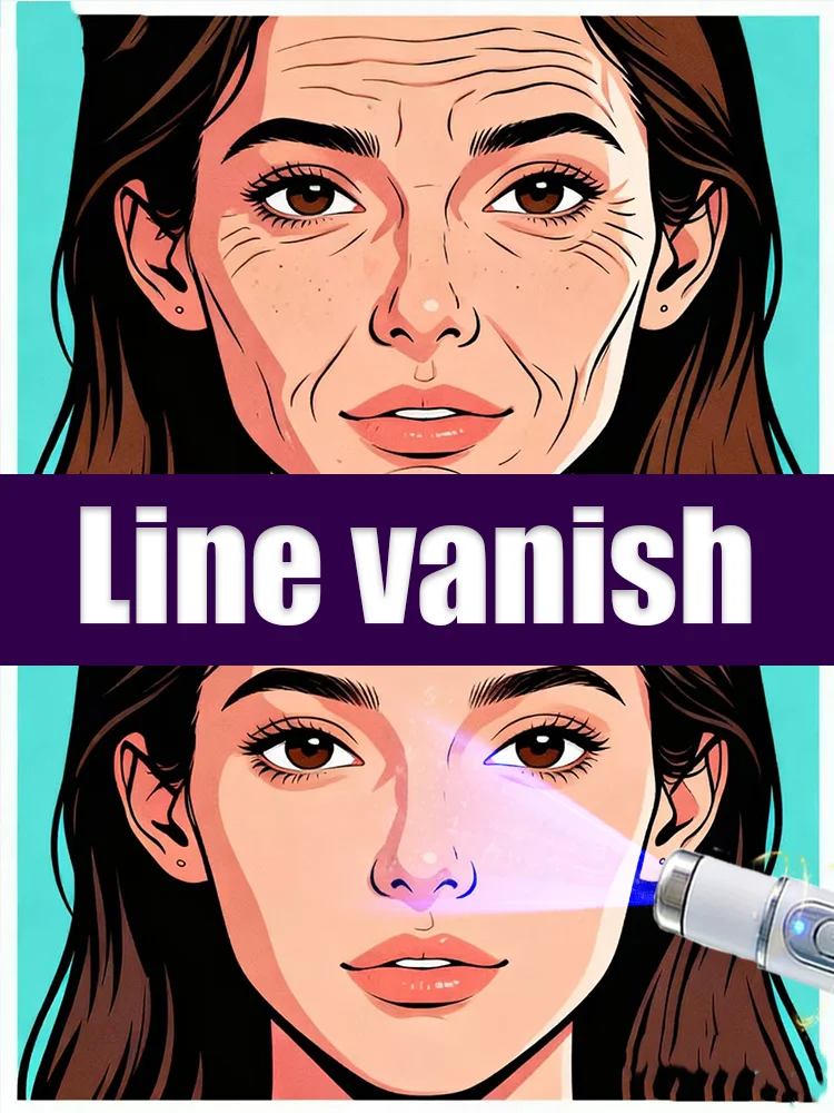 

Blue light pen for facial wrinkle removal and women looking younger