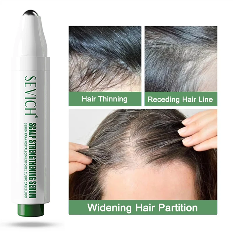

Rosemary Hair Growth Roller Essence Improves Scalp Health Stimulates Follicle Activity Reduces Hair Breakage Increases Density