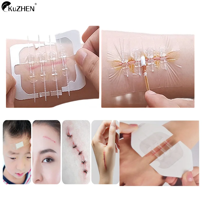 1/2/3/10Pcs Zipper Tie Wound Closure Patch Hemostatic Patch Wound Fast Suture Zipper Band-Aid Outdoor Portable Skin Care