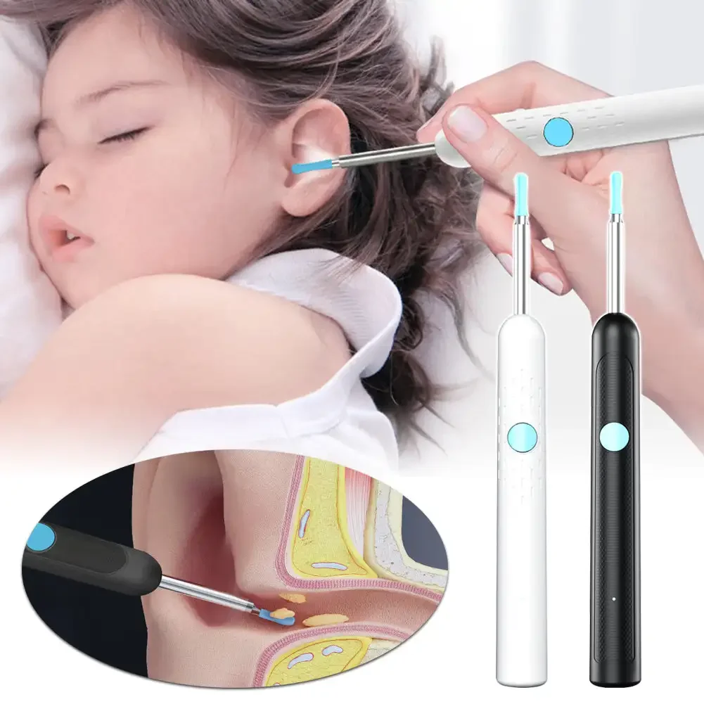 High-definition Intelligent Visual Ear Digging Spoon Wireless Rechargeable Luminous Ear Cleaner Ear Wax Removal Tool Ear Care