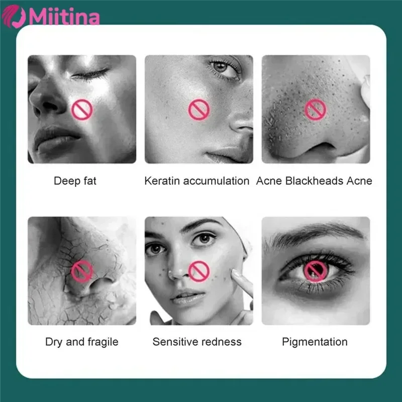 Miitina USB rechargeable blackhead remover, pore cleansing, electric silicone cleansing brush, vibrating sonic massager