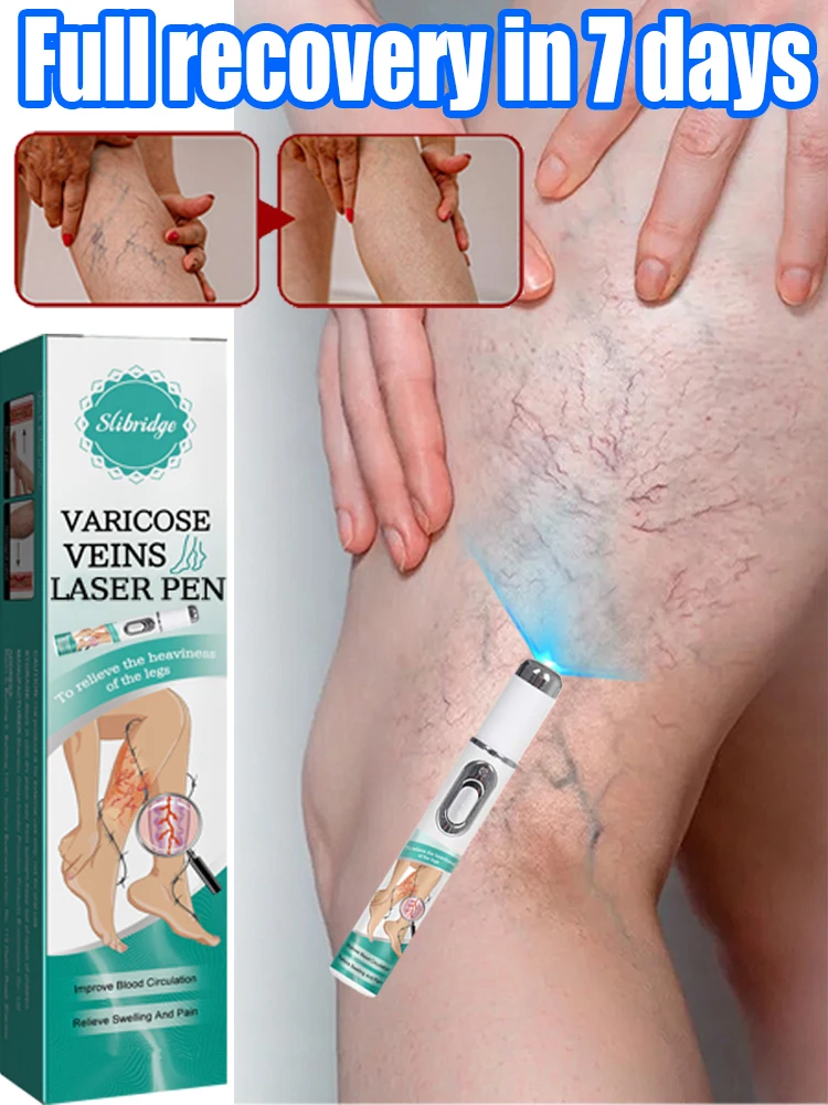 Hot sale Nano Laser Leg Vein