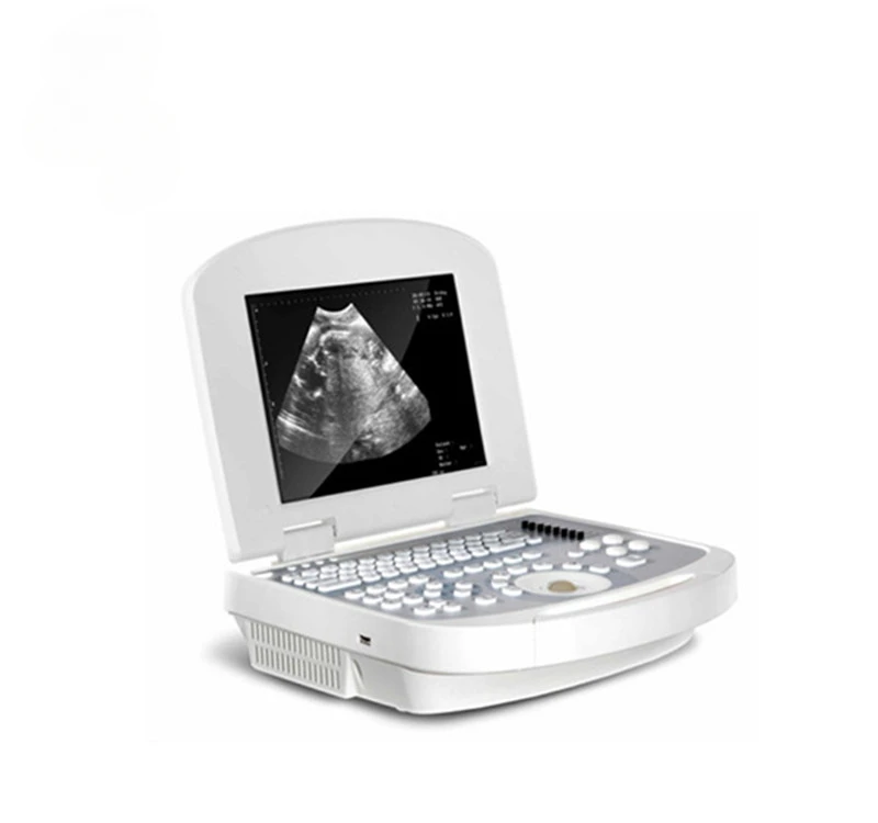 

Hospital Medical Devices Multi Parameters Veterinary Ultrasound Scanner