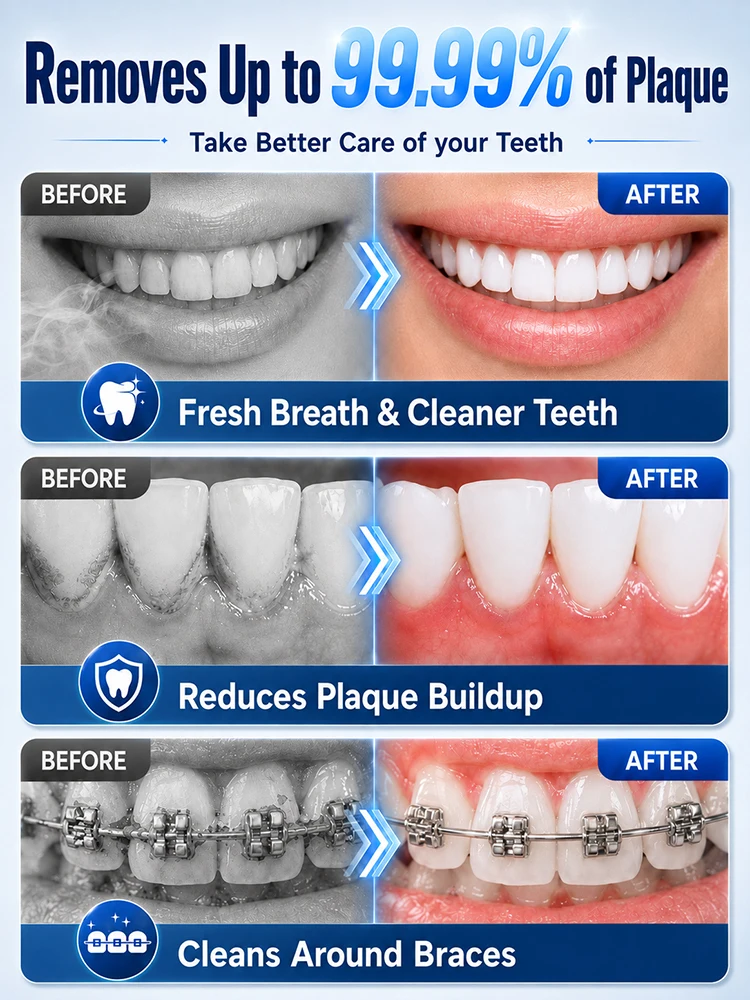 Thumbnail 3 - #3 Compare Dental Water Jets Before You Buy
