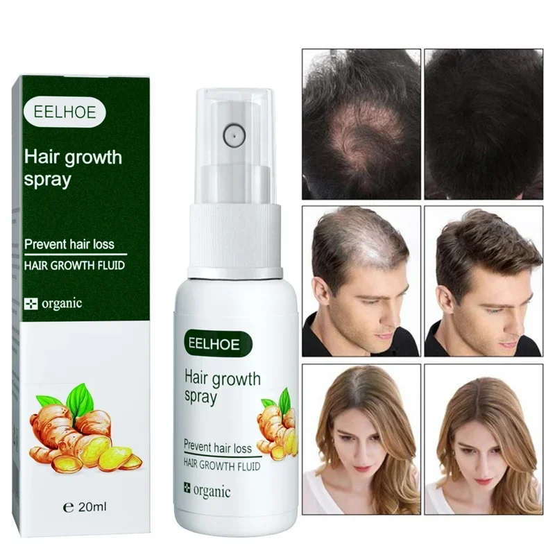 Ginger Serum Hair Growth Spray  Anti Hair Loss Products Fast Growing Prevent Baldness Treatment Germinal Liquid Men Women