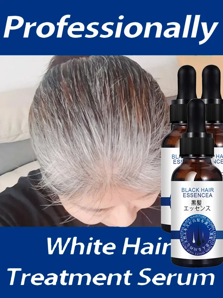 

Anti Gray Hair Essence Blackening Serum Treatment White To Black Hair Repair Care Nourish Scalp Anti Hair Loss Beauty Products