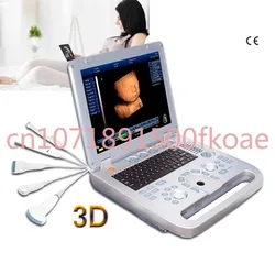 Portable 3d Ultrasound Machine Medical Scan Digital Pseudo Color Usg 4d Optional Ecography