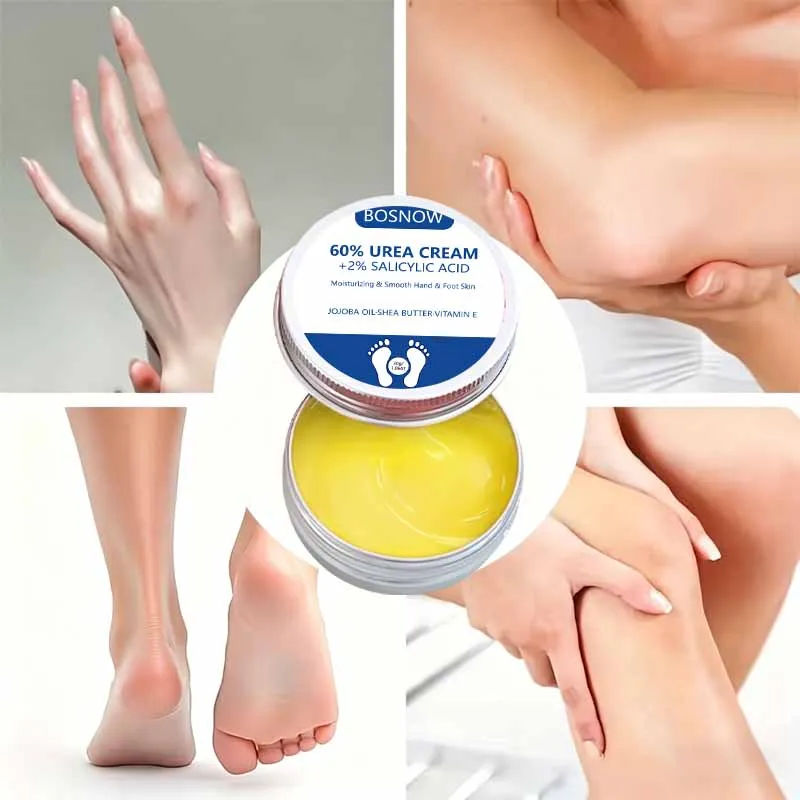 1Pcs/2Pcs/3Pcs【Anti-Extreme Dryness】60% Urea + 2% Salicylic Acid Hand and Foot Balm, Quick and Deep Hydration, Moisturizes and Locks in Moisture, Cares for Barrier Skin, Nourishes, Softens, and Smooths Skin, Suitable for Extremely Dry, Cracked, and Rough Hands and Feet