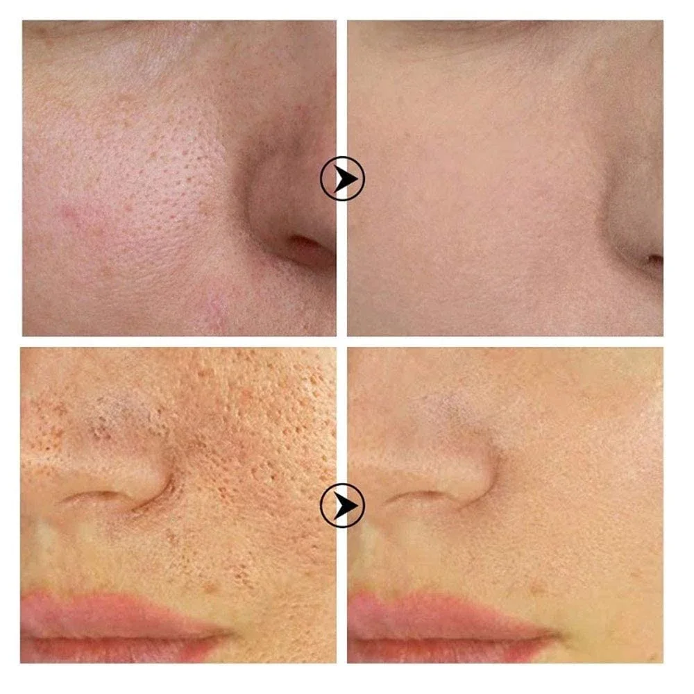 Soro Facial Iluminador com Retinol e Niacinamida, Refinação e Resurfacing do Poro, Textura da pele