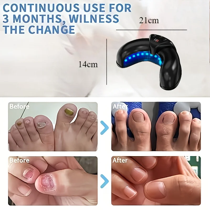 

1/2/4 Pcs Nail Fungus Light Device for Multiple Fingernails & Toenails