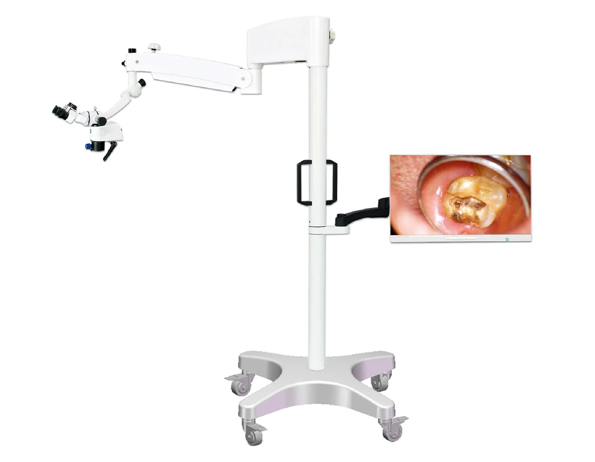 Dental Operating Microscope