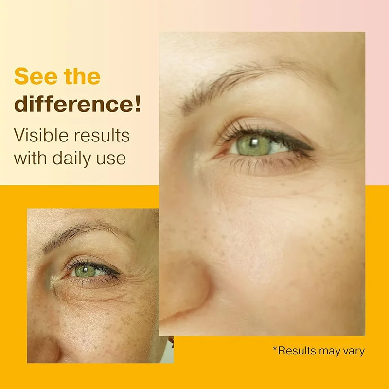 

Vitamin C Facial Serum for Hydration and Moisturizing, Anti-Fatigue Serum