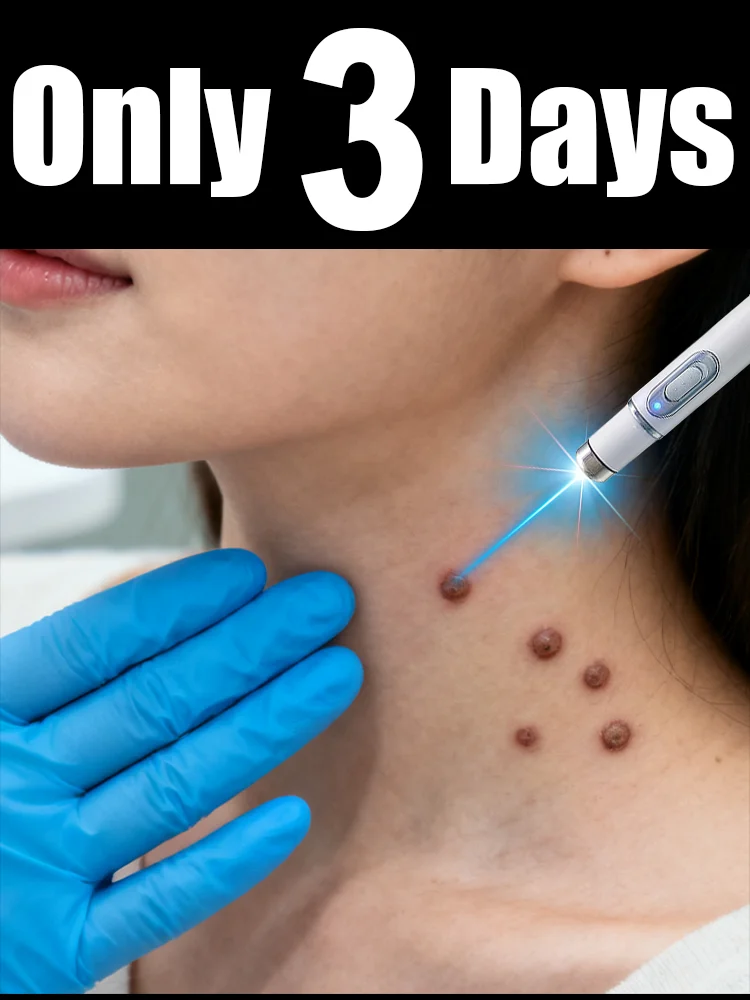 

The first generation of improved wart repair agent wart root fast