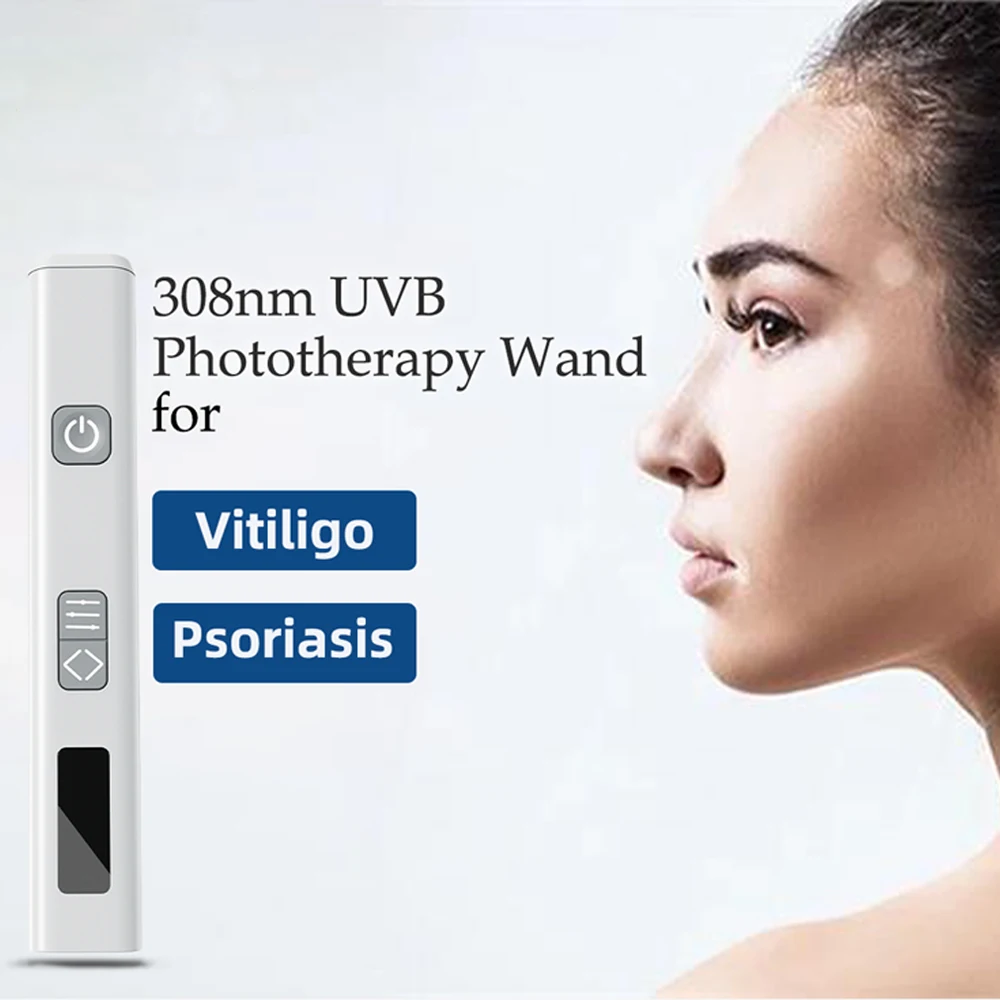 

Mini 308nm UVB lamp vitiligo instrument for Vitiligo tratamento and Psori-asis Treatment Handheld Medical Device Home Nursing