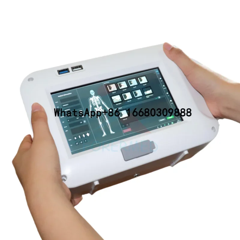 Fashion Medical Portable DR X-ray System Built-in Computer Hand held Flat Panel Detector X-ray Touch Screen Digital Xray Machine