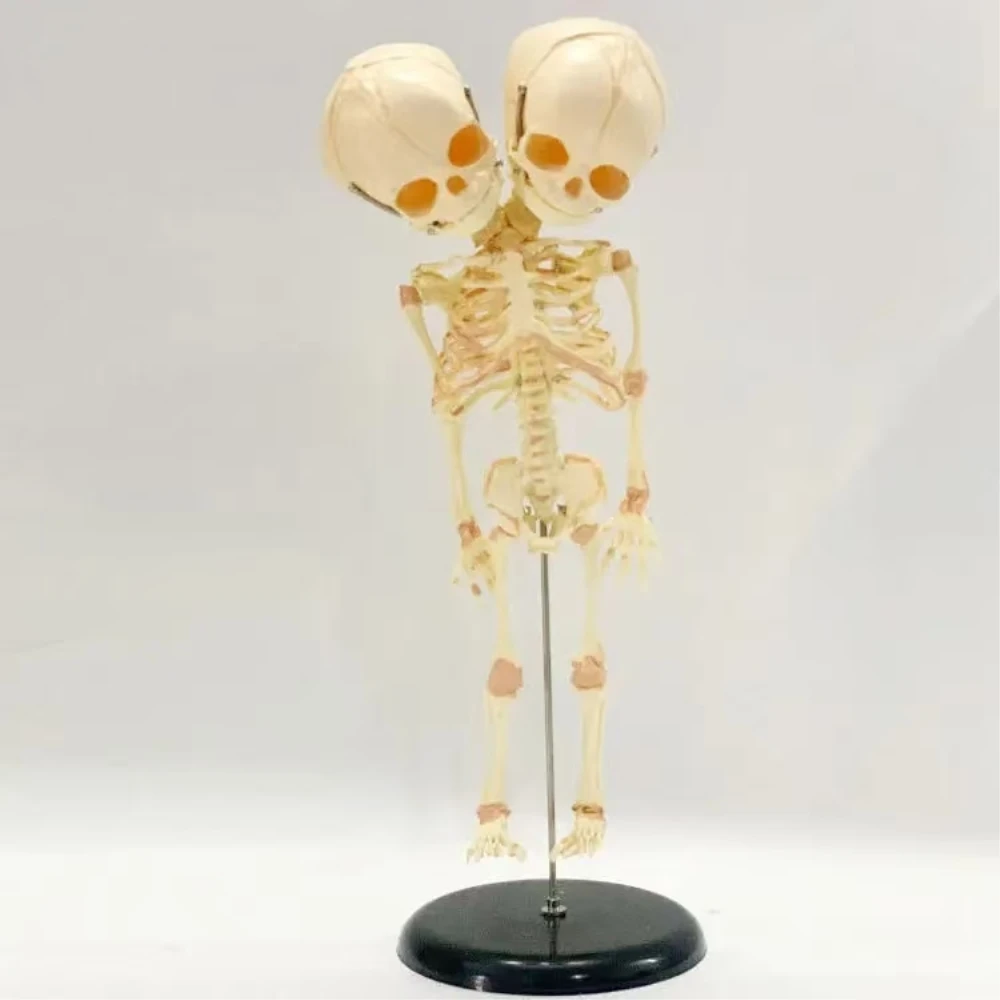 37cm Human Double Head Baby Skull Skeleton Anatomy Brain Display Study Teaching Anatomical Model Halloween Bar Ornament