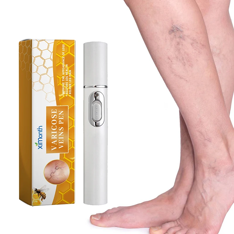 Laser Therapy Leg Repair Pen, Reduzir Imconfortável para as Pernas, Melhorando a circulação sanguínea, Varizes, Produto de cuidados com a pele, Novo