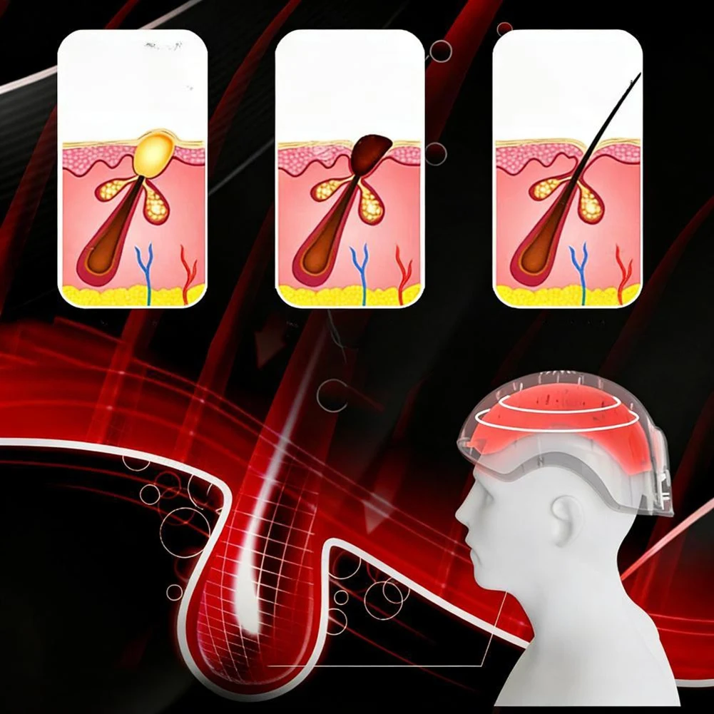 【BRAND NEW】Growth Hair Regrowth 700Nm LED Photon Scalp Care Device For Thinning Scalp Relief, For Anti-Hair Loss, Stress Reducti