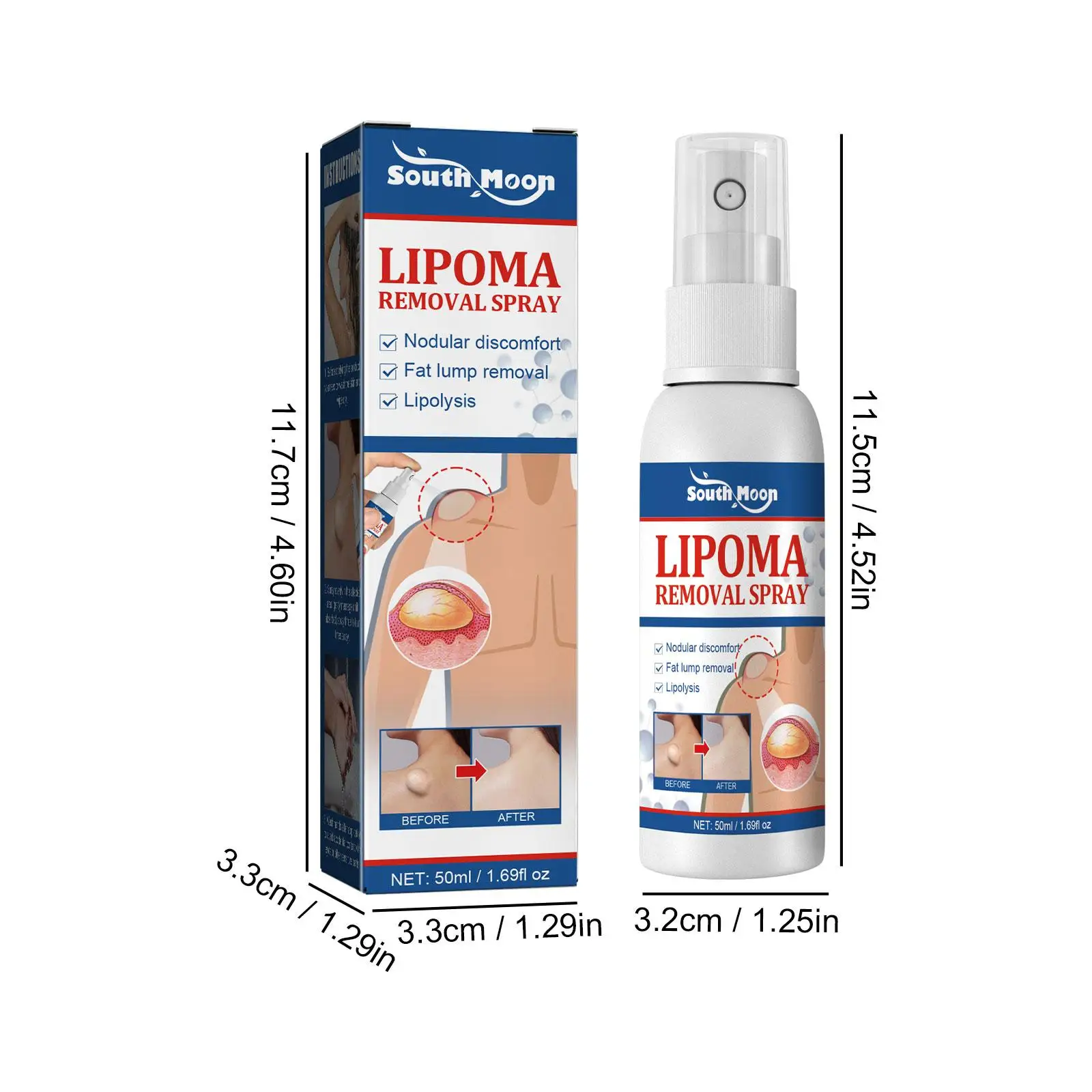 Lipoma Removal Spray Pain Treatment For Skin Swelling Fat Soluble Cellulite Fat Nodule Removal Cream Anti-tumor 50ml