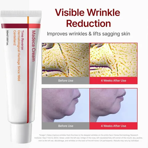 Imagen 2 del producto Madeca Cream Time Reverse Advanced Crema nutritiva de absorción rápida, hidrata, reduce las arrugas, antienvejecimiento, cuidado de la piel coreano