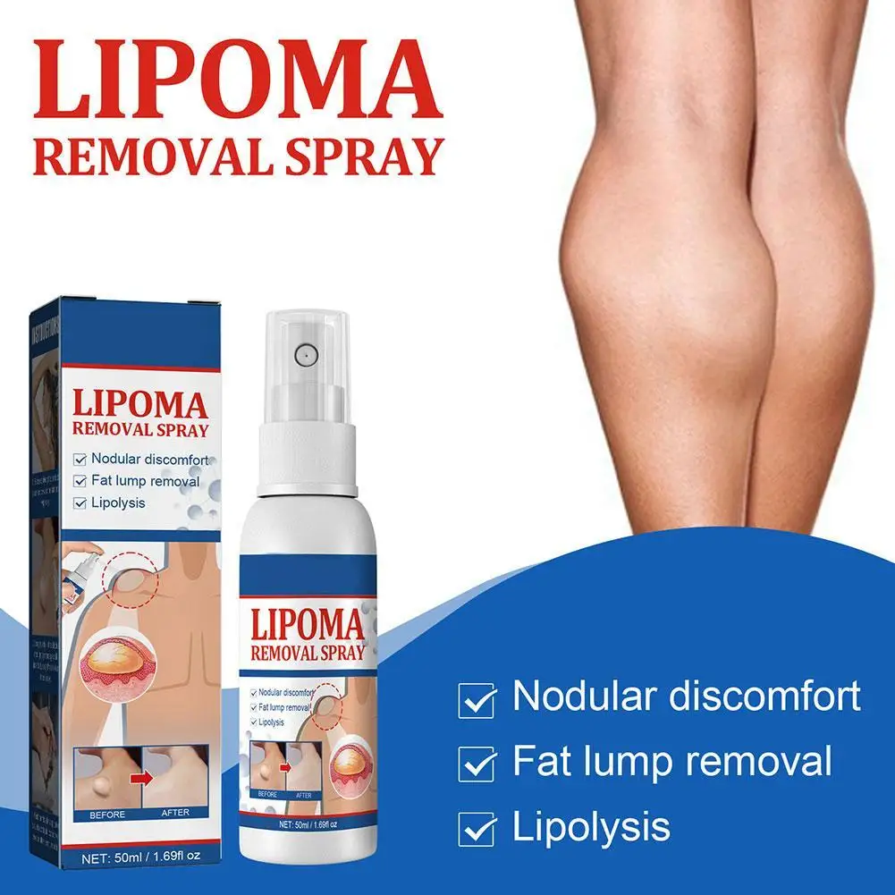 Lipoma Removal Spray Anti Tumor Skin Swelling Pain Lipolysis Cellulite Treatment Fibroma Subcutaneous Fat Lump Relief Cream 50ml