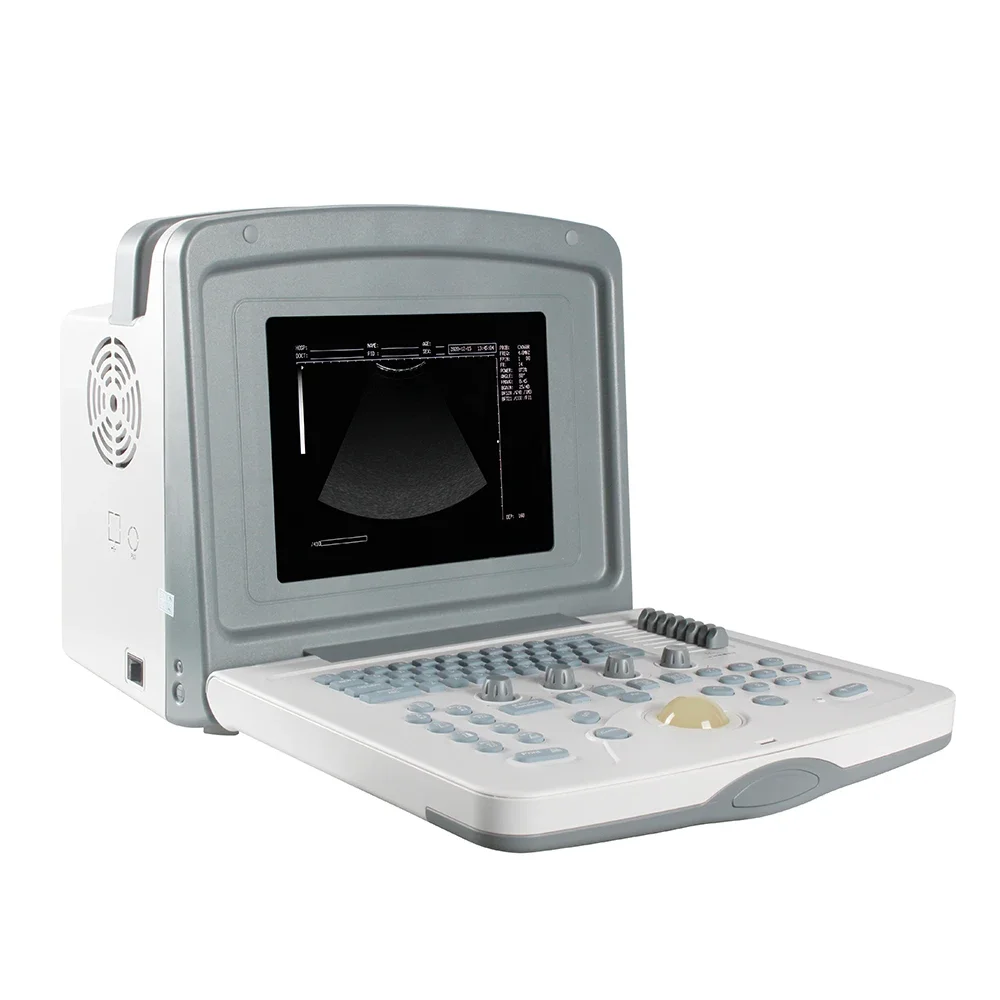 

Hospital Diagnostic Equipment Laptop Escaner Ultrasonido Medical Portable B Ultrasound Machine