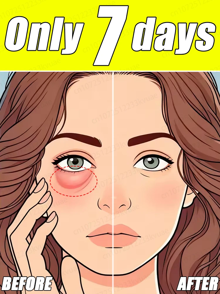 DIGA GOODBYE PARA SUAS FIELAS! GANHE RID OF EYE BAGE E CIRCLOS DARK EM JUST 7 DIAS.