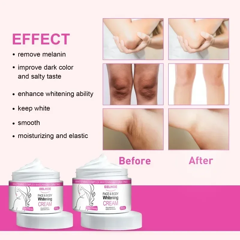 Face Body Brightening Cream Thigh Underarm Inner Melanin Lightening Lotion Feminine Gentle Nourishing Dark Skin Care Cream