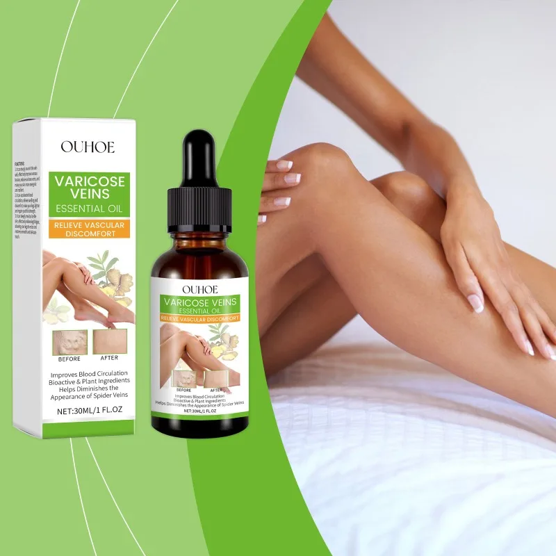 Varicose Vein Essential Oil Relief Phlebitis Spider Varicose Pain Treatment Body Feet Effective Repair Vein Care Health 30ml