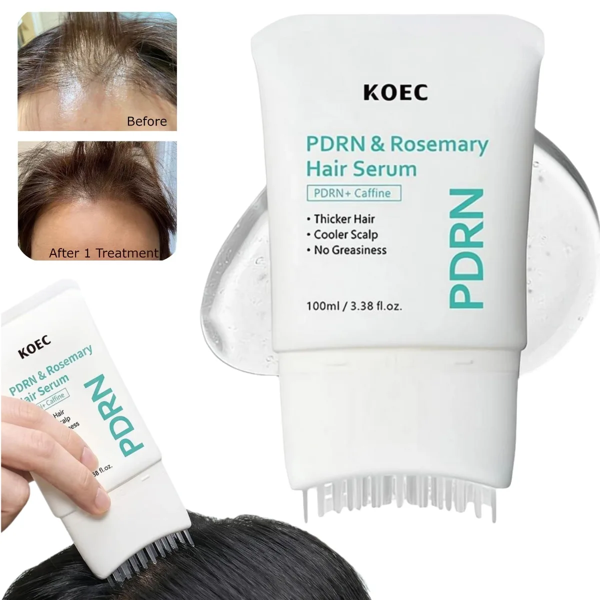 Korea Hair Thicken Exosome Comb Ampoule, Microneedling Nourishing Hair Regrowth Care Biotin Serum,Grow&Turn Scalp Repair Serum
