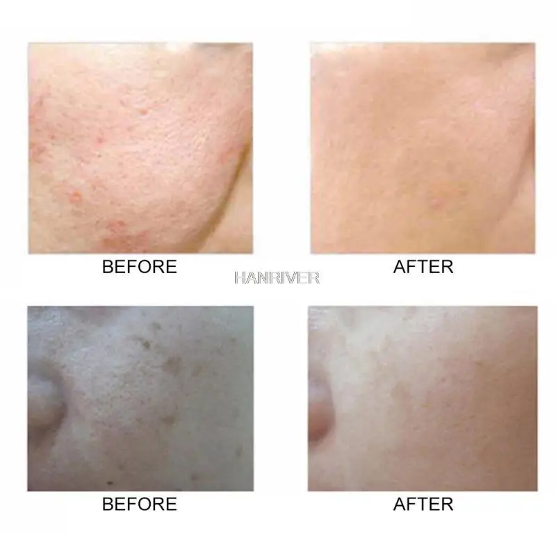 1pcs Skin Care Tool Double Side Silicone Cleansing Facial Brush Face Exfoliating Spa Massage Deep Pore Skin Care  Beauty Tools