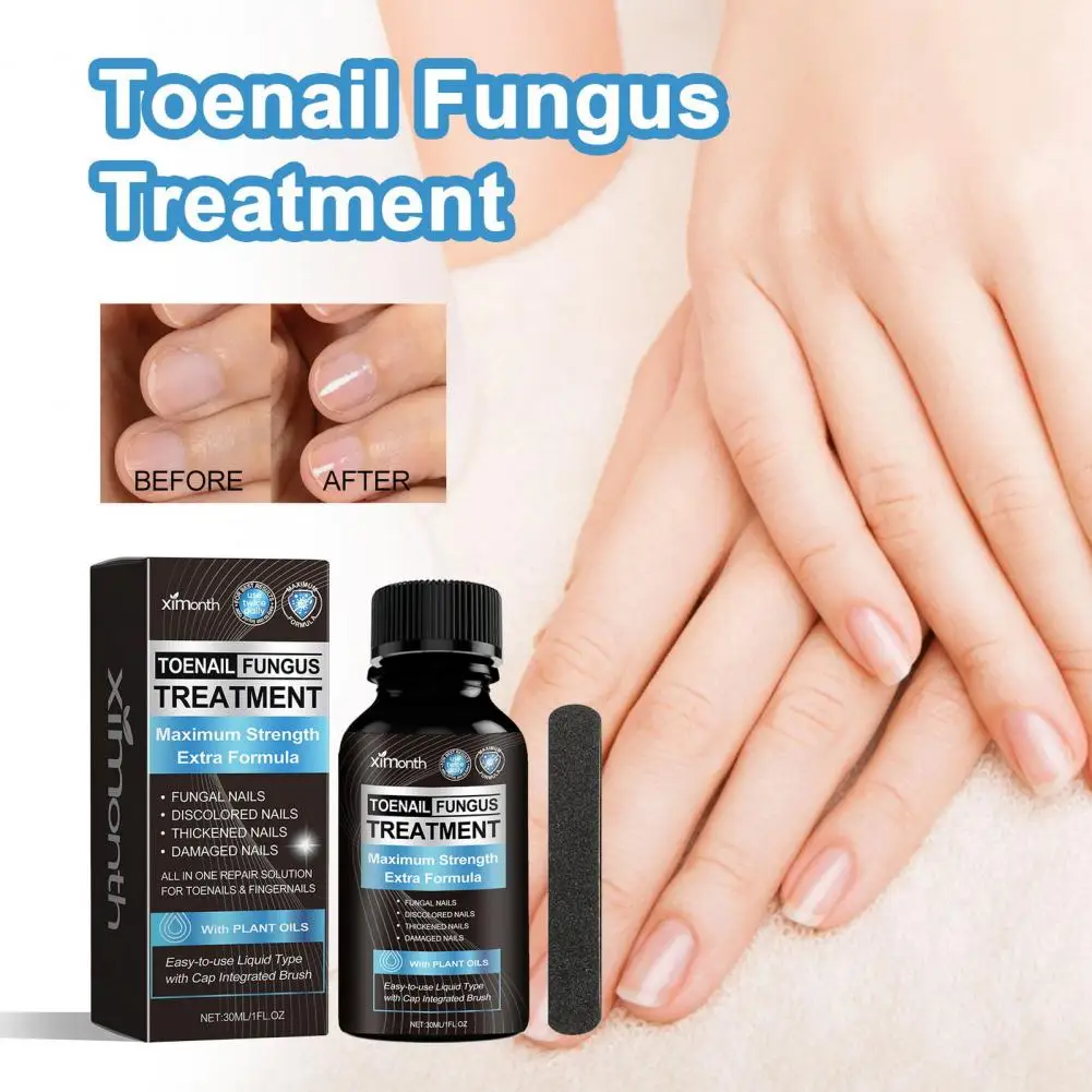 Home Remedy for Toenail Fungus Natural Extra Strength Nail Fungus Treatment Solution for Healthy Toenail Fingernails Repair