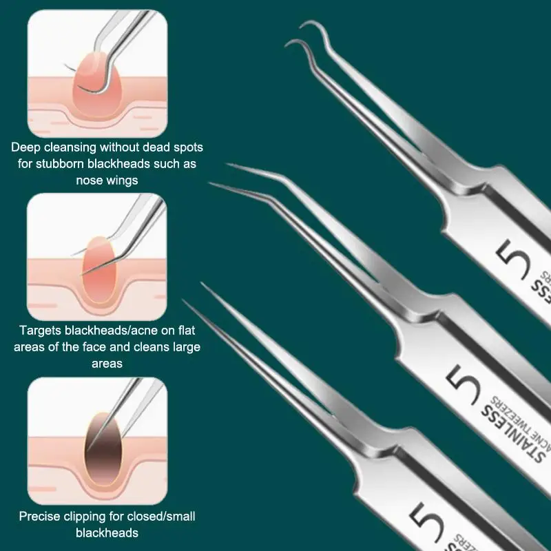 7/8Pcs Blackhead Remover Kit Professional Blackhead  Needle Skin Care Tools Stainless Steel Pimple Extraction Tools view 3