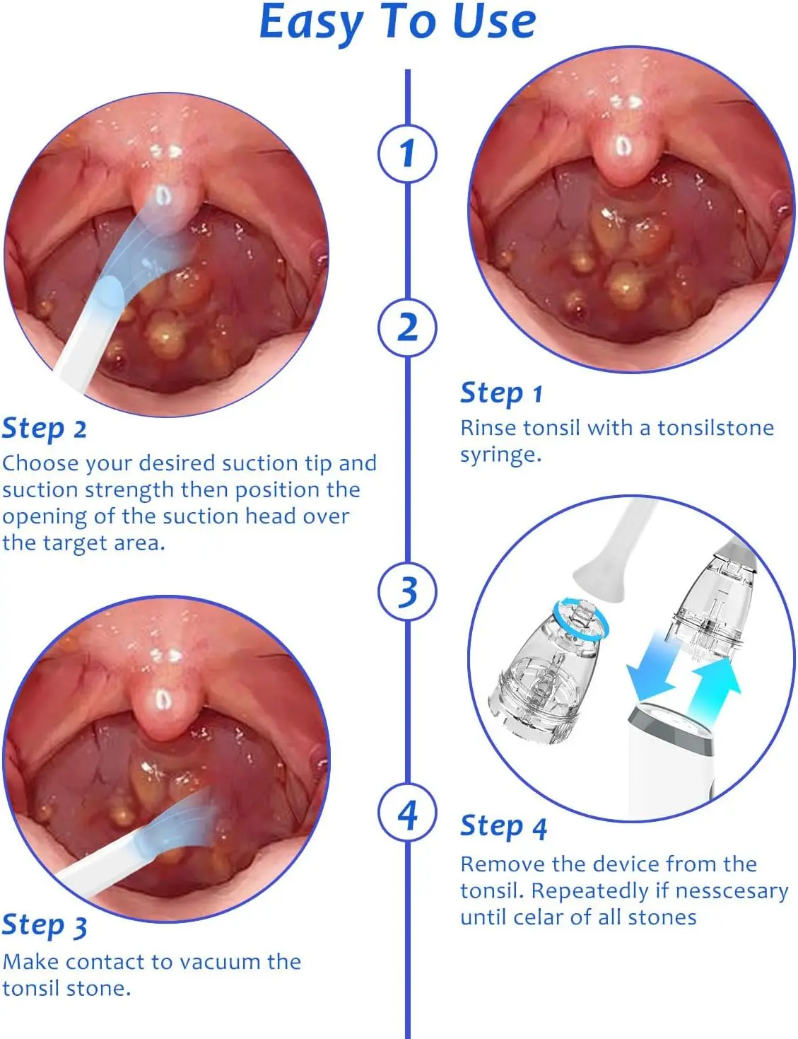 Electronic Vacuum Tonsil Stone Remover Kit with LED light 8 Suction Modes Anti Bad Breath Oral Fresh Care&Tongue Coating Scraper view 5