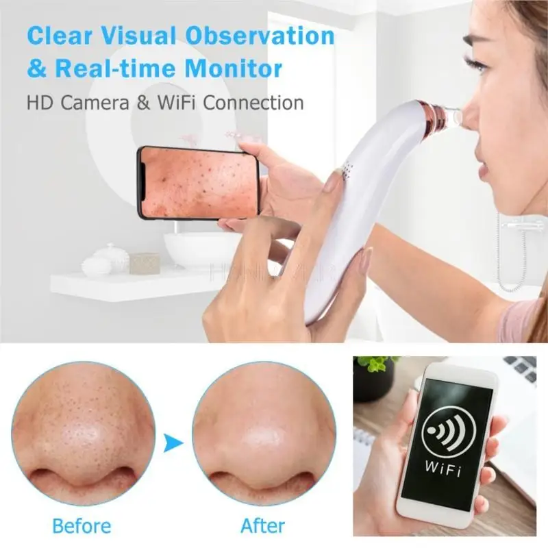 Wifi visualizado instrumento de sucção cravo doméstico elétrico acne para cravo poros limpeza instrumento beleza