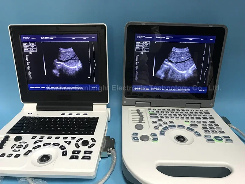 Cheap Ecograph Laptop Black and White Ultrasound cheaper than logiq ultrasound 2D machine