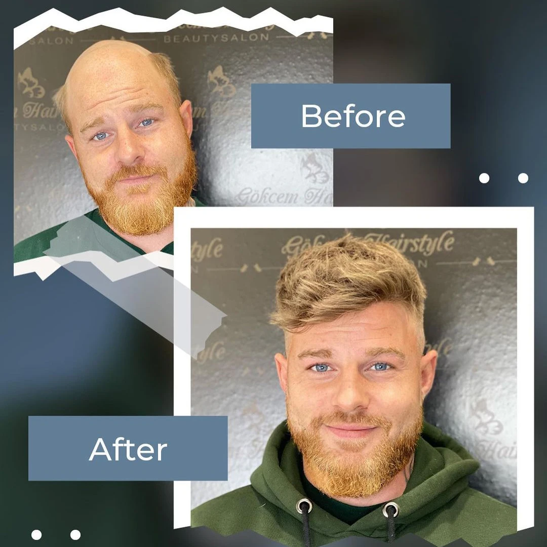 Ash Blonde Men's Toupee Hair System
