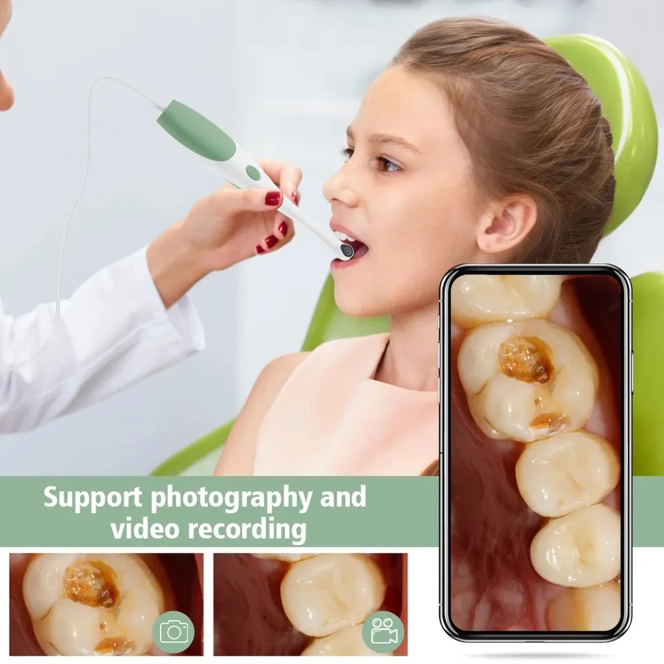 1080P HD Intraoral Camera Mini Camera USB 3 IN 1 Connection Visual Examination Endoscope Home Care Tools for Android PC