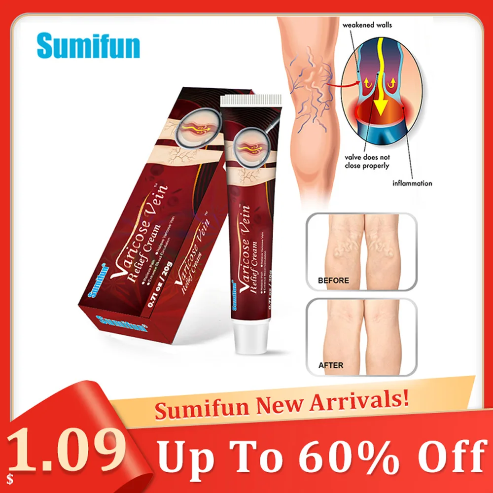 

20g/box Varicose Veins Treatment Cream Effective Cure Varicosity Angiitis Spider Leg Ointment Phlebitis Vasculitis ReliefPlaster