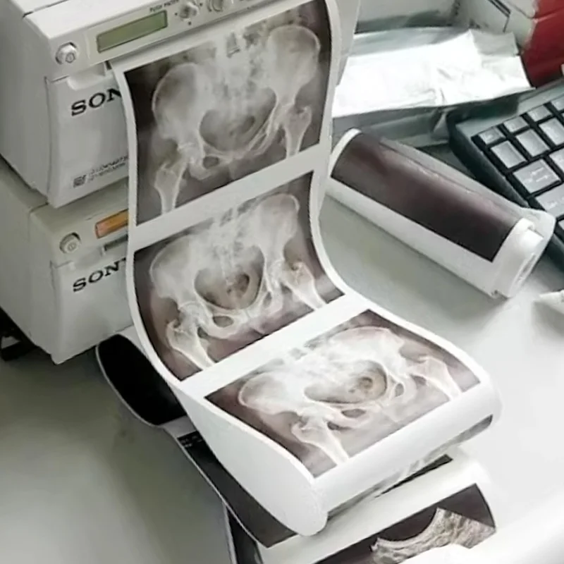 10 Roll UPP-110HG Ultrasound Printing Paper Media Video Imaging For Compatible Sony P-890,UP-895MD D895 UP-897MD UP-D897 Printer