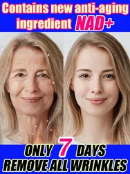 Return to youth, eliminate signs of aging, and tighten skin