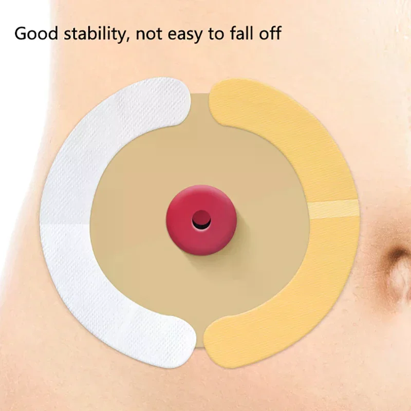 20 Pcs/Box Bag Elastic Ostomy Barrier Strips Hydrocolloid Waterproof Leak Skin Adhesive Tape for Colostomy