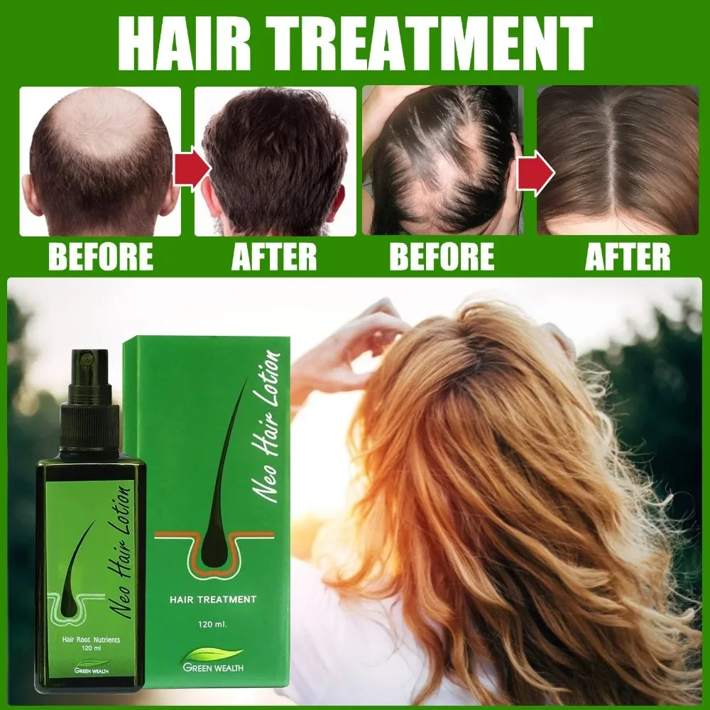 

Hair Care Lotion 120 ml Hair Regrowth Treatment Growth Strengthens Damaged Hair Loss Revitalizes Scalp For Men & Women