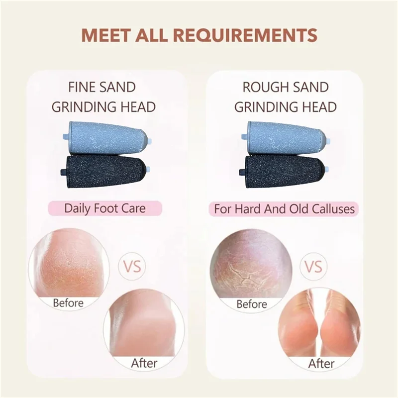 مزيل مسامير القدم الكهربائي مزيل مسامير القدم ينطبق على إزالة مسامير القدم